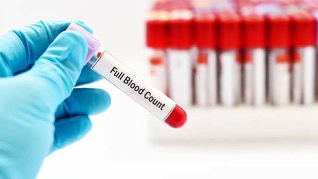 Private hospital fined Rs. 500,000 for overcharging FBC test in Vavuniya